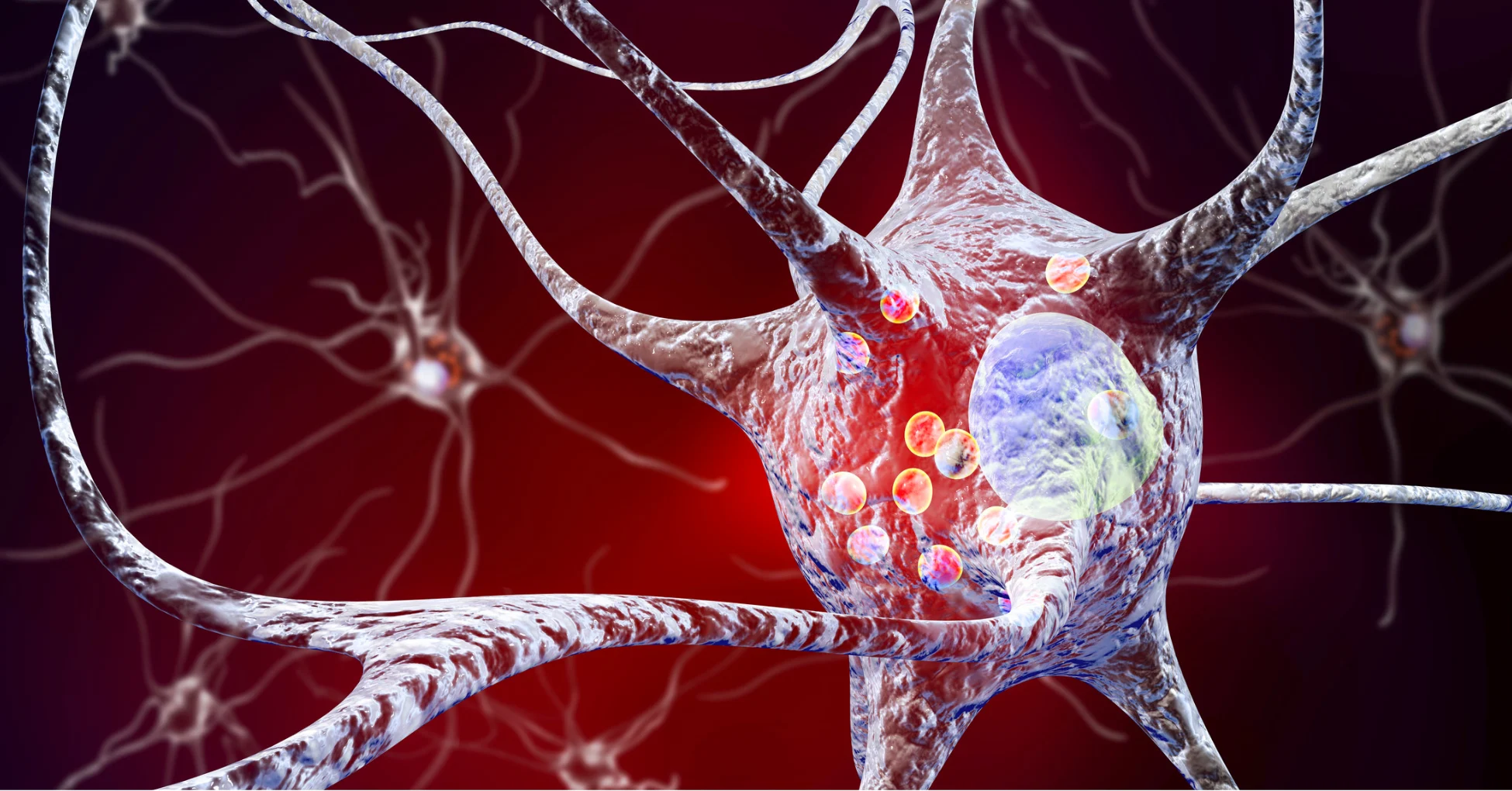 Understanding the 5 Stages of Parkinson's Disease